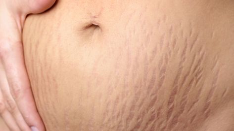 SQT Body Clarifying treatment results